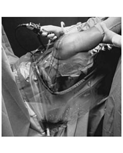 3M Healthcare U-Drape, 47" x 70", U-Slot Aperture with Adhesive, Clear Plastic, 40/CS