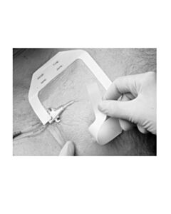 3M Healthcare Frame Style Transparent Dressing, 4" x 4½" with Label, 200/CS