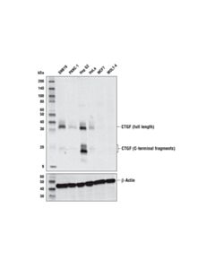 Cell Signaling Ctgf (E2w5m) Rabbit mAb