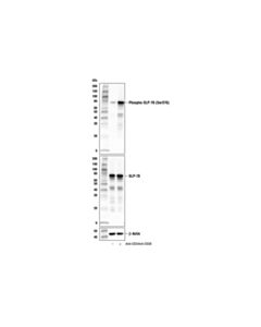 Cell Signaling Phospho-Slp-76 (Ser376) (E3g9u) Rabbit mAb (BSA And Azide Free)