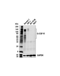 Cell Signaling g-Csf-R (E8e7d) Rabbit mAb