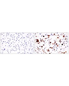 Cell Signaling Il-8 (E5f5q) Rabbit mAb (BSA And Azide Free)