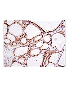 Cell Signaling Deptor/Depdc6 (D9f5) Rabbit mAb