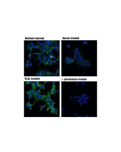 Cell Signaling Phospho-Acetyl-Coa Carboxylase (Ser79) (D7d11) Rabbit mAb