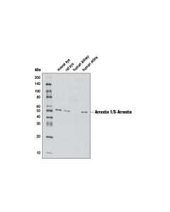Cell Signaling Arrestin 1/S-Arrestin Antibody