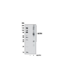 Cell Signaling Sstr1 Antibody