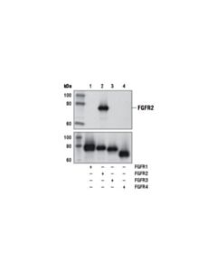 Cell Signaling Fgf Receptor 2 (D4h9) Rabbit mAb