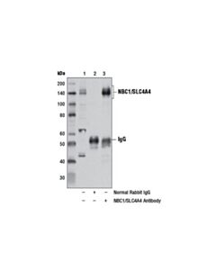 Cell Signaling Nbc1/Slc4a4 Antibody