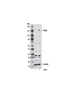 Cell Signaling Toll-Like Receptor 8 (D3z6j) Rabbit mAb