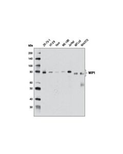 Cell Signaling Wip1 (D4f7) Rabbit mAb