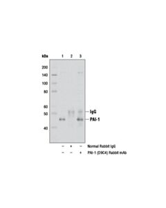 Cell Signaling Pai-1 (D9c4) Rabbit mAb