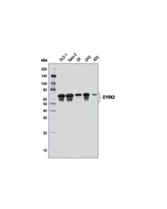 Cell Signaling Dyrk2 (D9a3k) Rabbit mAb