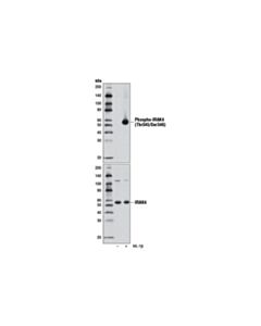 Cell Signaling Phospho-Irak4 (Thr345/Ser346) (D6d7) Rabbit mAb
