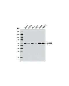 Cell Signaling Beta-Trcp (D12c8) Rabbit mAb