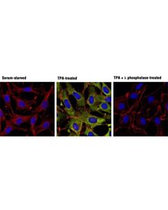 Cell Signaling Phospho-P90rsk (Ser380) (D3h11) Rabbit mAb