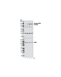 Cell Signaling Phospho-Ddr1 (Tyr792) Antibody