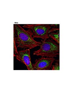Cell Signaling Sdha (D6j9m) Xp Rabbit mAb 