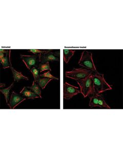 Cell Signaling Glucocorticoid Receptor (D8h2) Xp Rabbit mAb (Alexa Fluor 488 Conjugate)