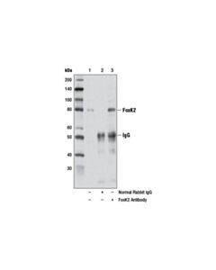 Cell Signaling Foxk2 Antibody