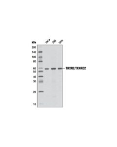 Cell Signaling Trxr2/Txnrd2 (3f2-E12-F10) Mouse mAb