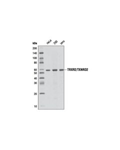 Cell Signaling TRXR2/TXNRD2 (3F2-E12-F10) Mouse mAb 20 uL