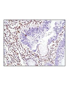 Cell Signaling Glucocorticoid Receptor (D6h2l) Xp Rabbit mAb