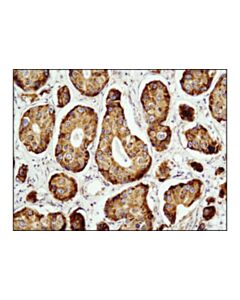 Cell Signaling Rcas1 (D6p5j) Rabbit mAb