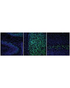 Cell Signaling Bcl-11b (D6f1) Xp Rabbit mAb