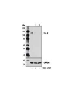 Cell Signaling Signalsilence Cbl-B Sirna I