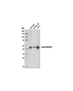 Cell Signaling Brn2/POU3F2 (D2C1L) Rabbit mAb 20 uL
