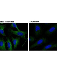 Cell Signaling Eml4 (D7y8f) Xp Rabbit mAb