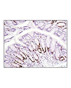 Cell Signaling Ki-67 (D3b5) Rabbit mAb (Mouse Preferred; Ihc Formulated)