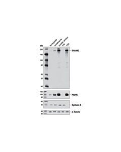 Cell Signaling Shank2 Antibody