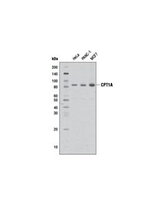 Cell Signaling CPT1A (D3B3) Rabbit mAb 20 uL