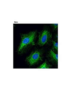 Cell Signaling Plectin-1 (D6a11) Rabbit mAb