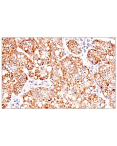 Cell Signaling Cox2 (D5h5) Xp Rabbit mAb