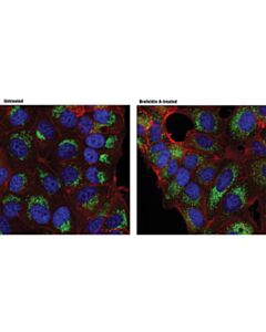 Cell Signaling Rcas1 (D2b6n) Xp Rabbit mAb