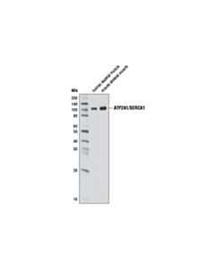 Cell Signaling Atp2a1/Serca1 (D54g12) Rabbit mAb