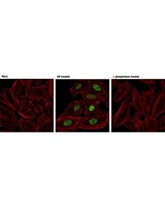 Cell Signaling Phospho-Chk1 (Ser317) (D12h3) Xp Rabbit mAb