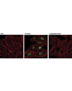 Cell Signaling Phospho-Chk1 (Ser317) (D12h3) Xp Rabbit mAb