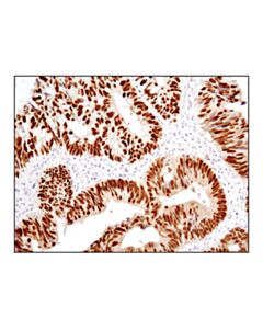 Cell Signaling Cdx2 (D11d10) Rabbit mAb