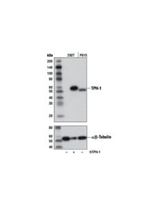 Cell Signaling Tph-1 (D10c10) Rabbit mAb