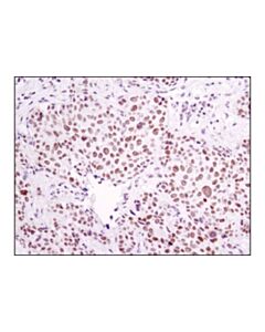 Cell Signaling Ercc1 (D6g6) Xp Rabbit mAb
