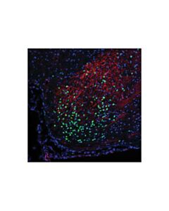 Cell Signaling Thyroid Transcription Factor 1 (Ttf-1) (D2e8) Rabbit mAb