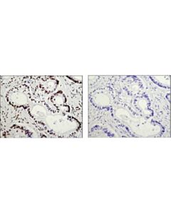 Cell Signaling Auf1/Hnrnp D (D6o4f) Rabbit mAb