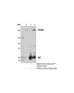 Cell Signaling Fip200 (D10d11) Rabbit mAb