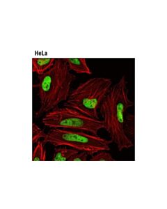 Cell Signaling Macroh2a1.1 (D5f6n) Rabbit mAb