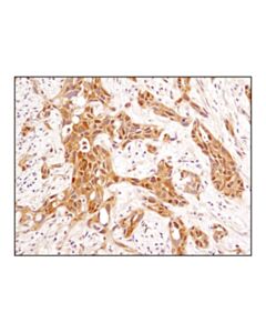 Cell Signaling Gsk-3beta (D5c5z) Xp Rabbit mAb
