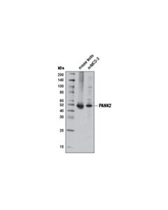 Cell Signaling PANK2 (D11E2) Rabbit mAb 20 uL