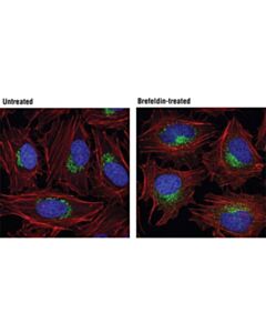 Cell Signaling Gm130 (D6b1) Xp Rabbit mAb